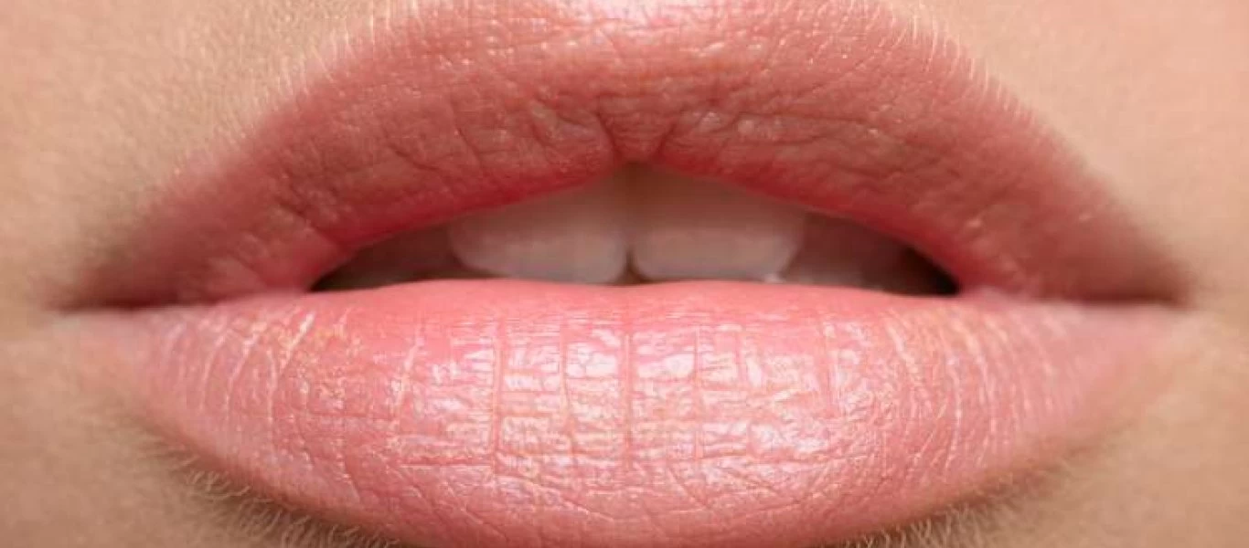 Τι πρέπει να ξέρετε για τον έρπη; - Πώς μπορεί να νοσήσει κάποιος;